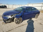 2015 Chrysler 200 Used Rear Stabilizer Bar Fwd 3.6L Oem 25D432 117K Miles. Fixed Price $80.70.